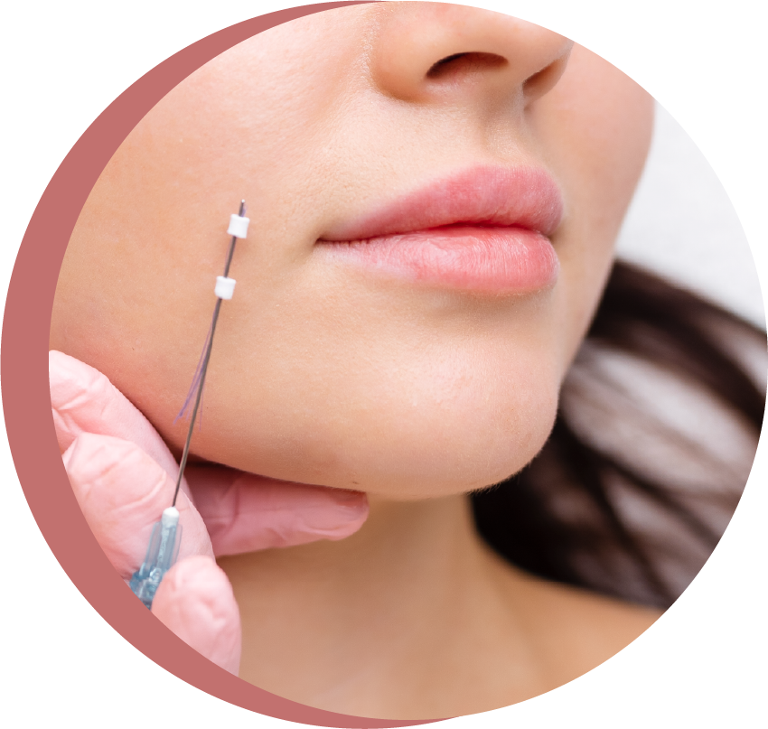 中醫 美顏針