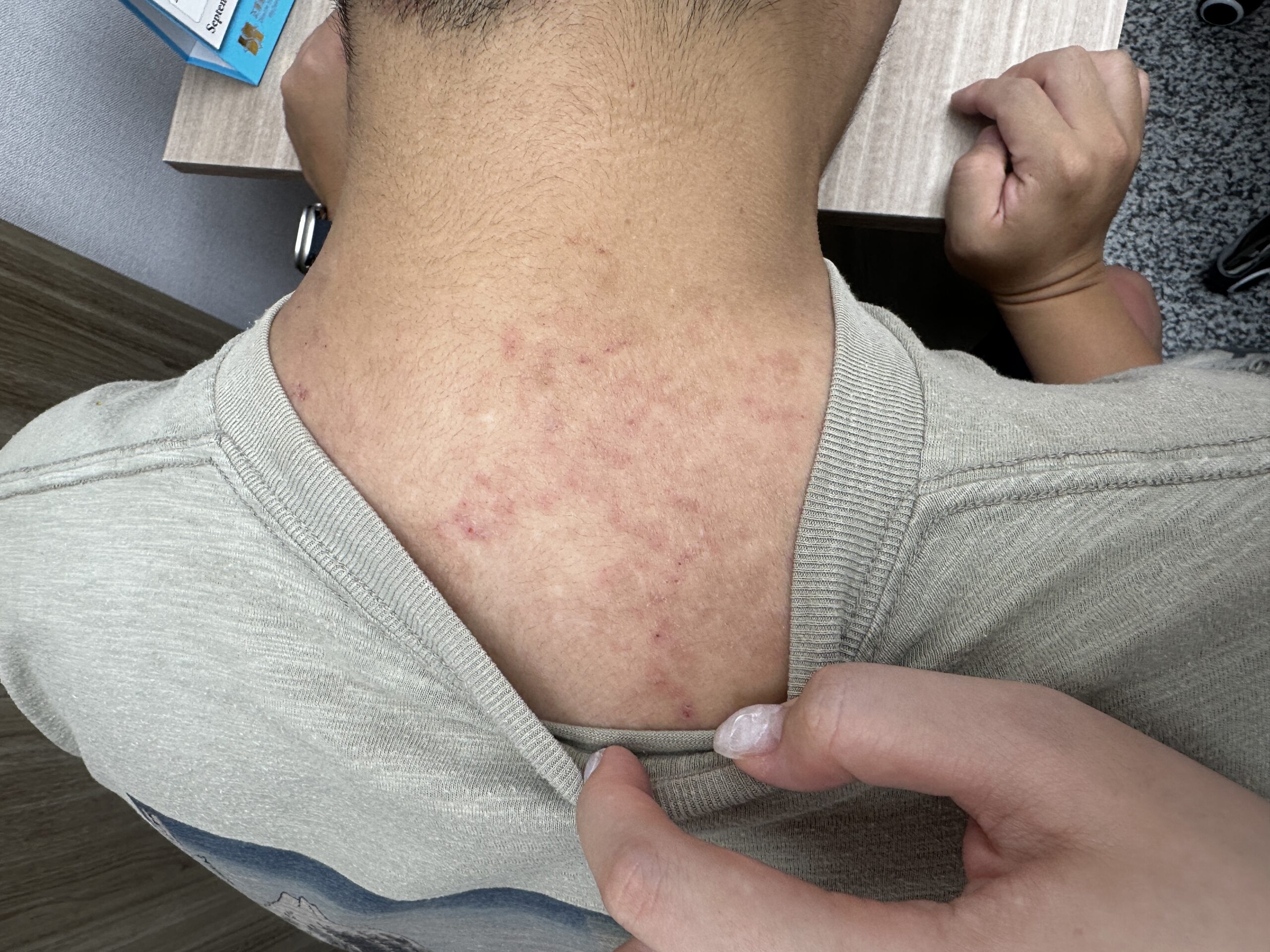 38歲奶爸的皮膚炎：其實是體內濕熱在作怪 - 藍依平中醫師｜依心為你-小藍中醫師