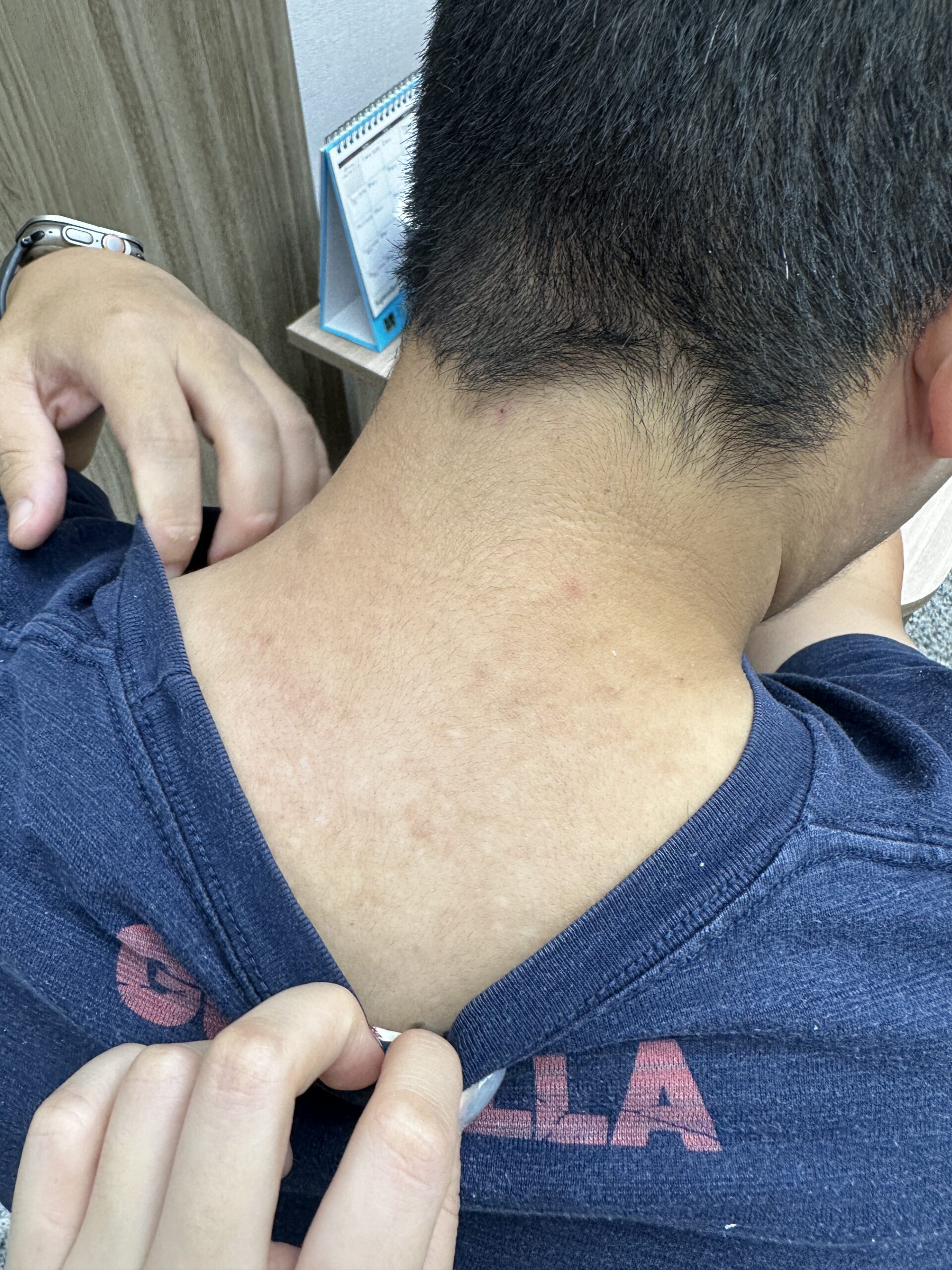 38歲奶爸的皮膚炎：其實是體內濕熱在作怪 - 藍依平中醫師｜依心為你-小藍中醫師