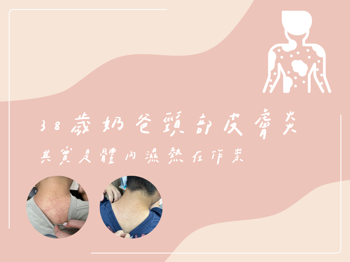 38歲奶爸的皮膚炎：其實是體內濕熱在作怪 - 藍依平中醫師｜依心為你-小藍中醫師